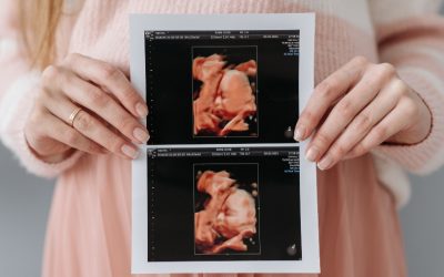 Yllättikö raskauden aiheuttama mielen vuoristorata sinutkin?